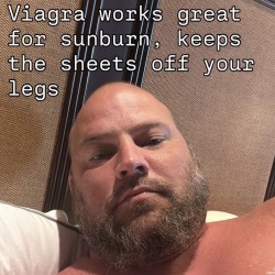 Great For Sunburn