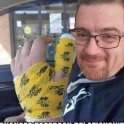 Breaks Hand