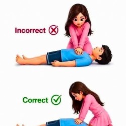 CPR Technique